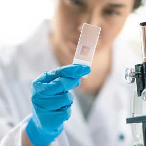 患者出院后培养结果阳性的处理策略